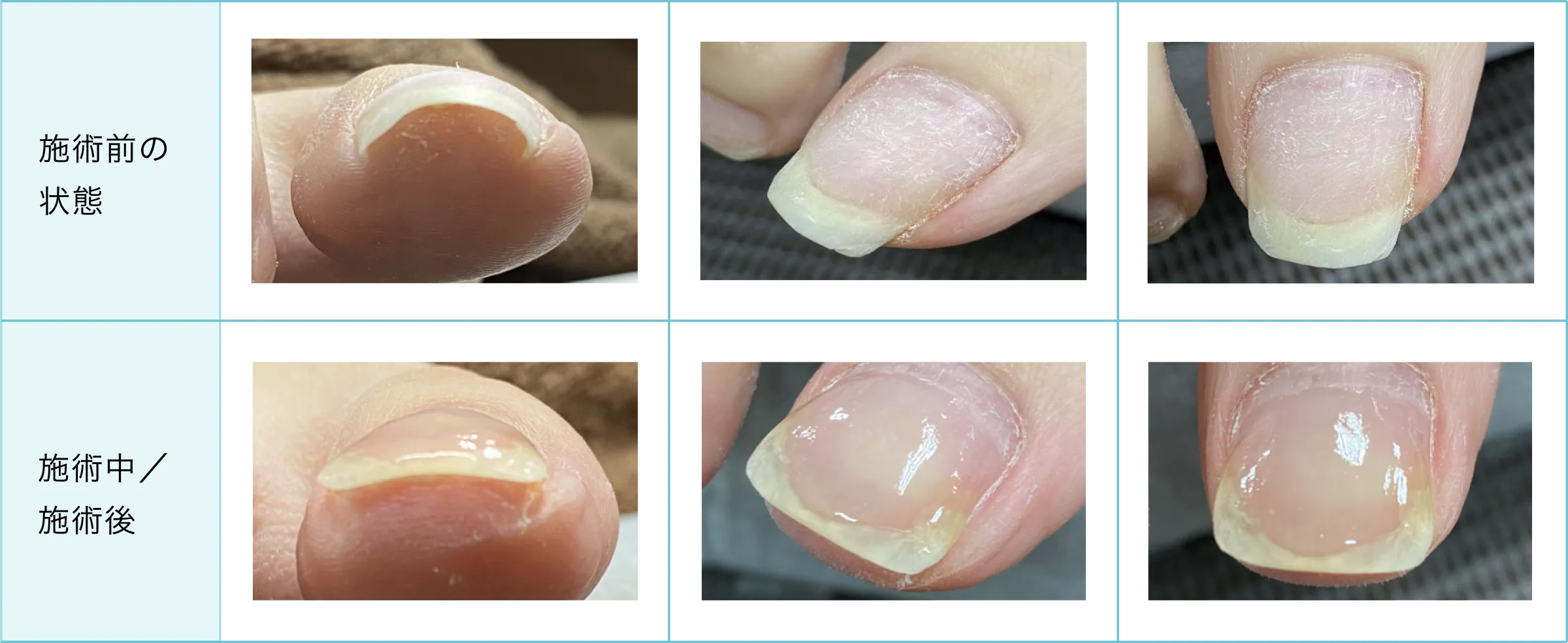 症例と施術経過