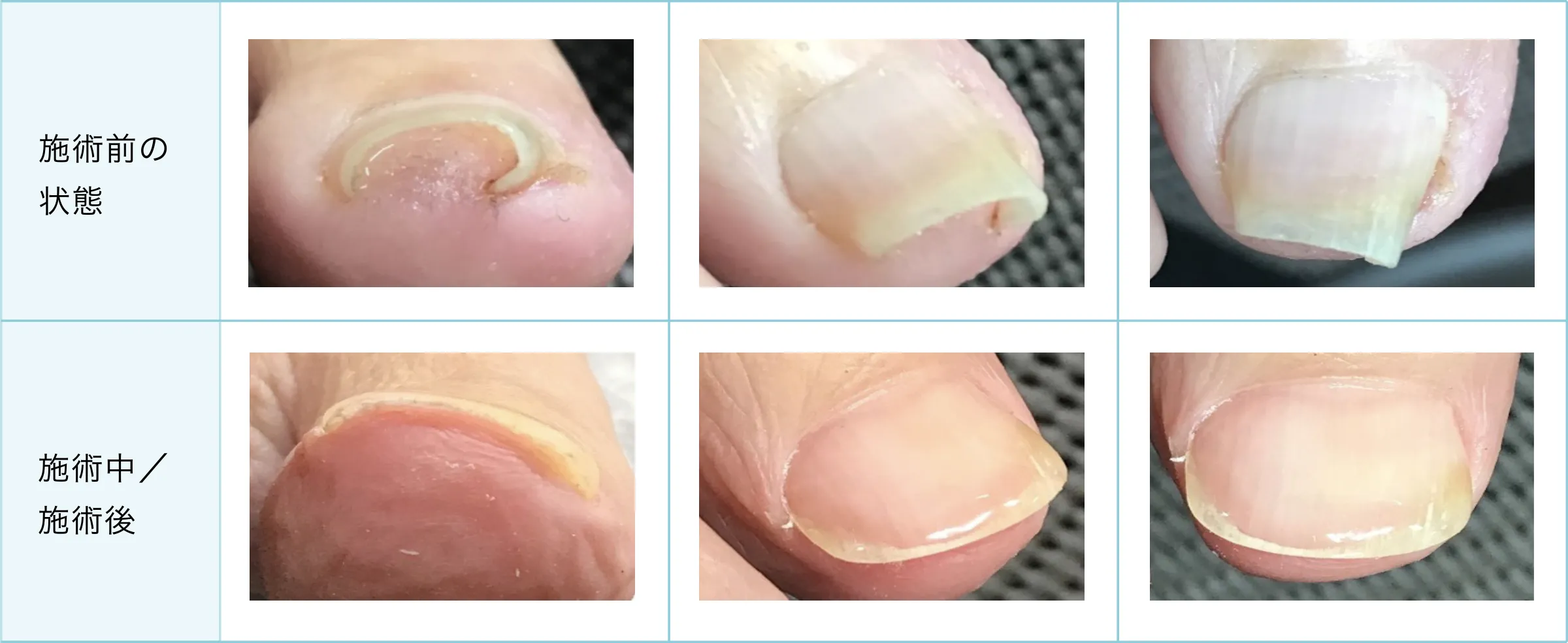 症例と施術経過