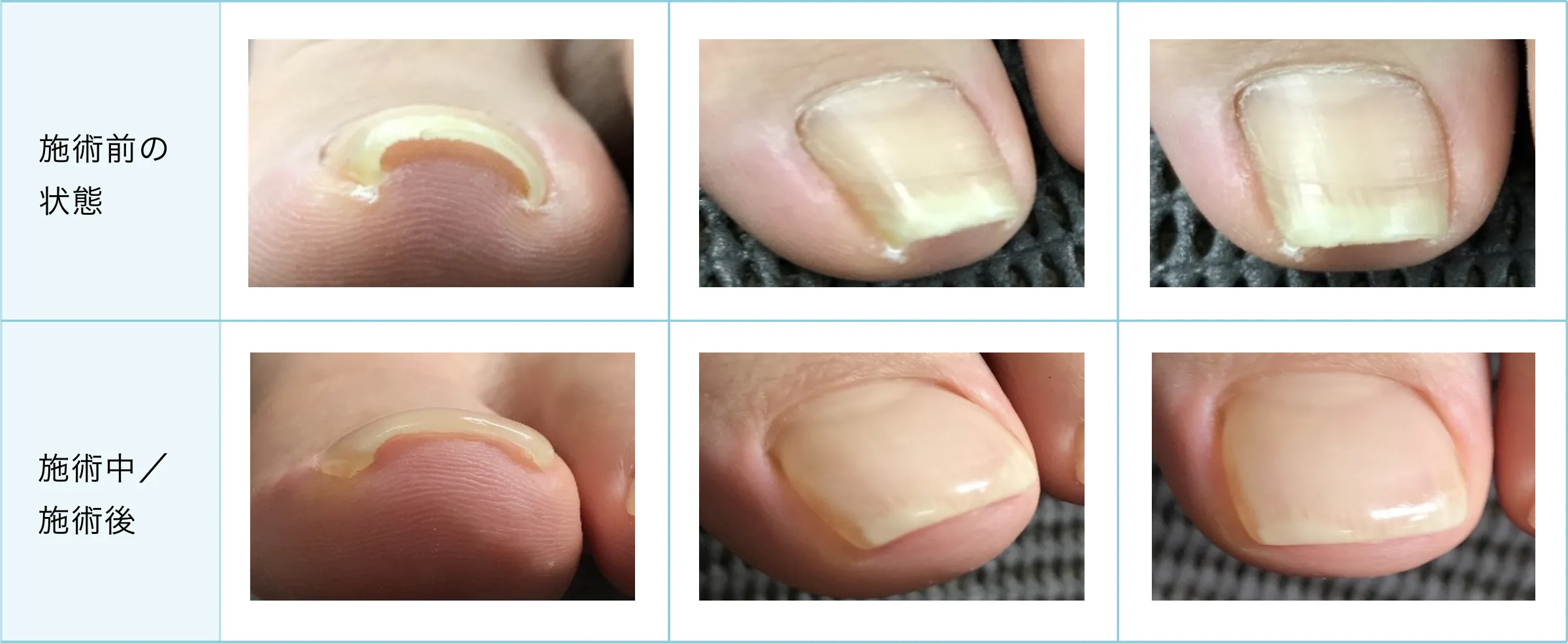 症例と施術経過