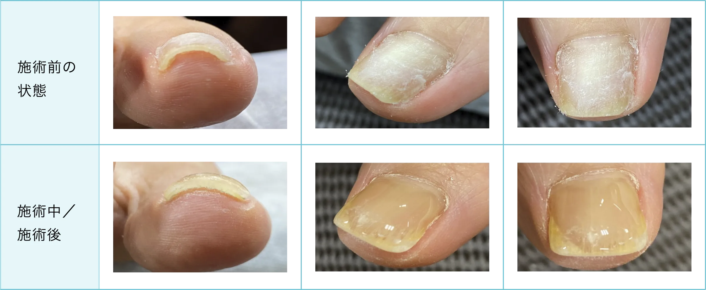 症例と施術経過