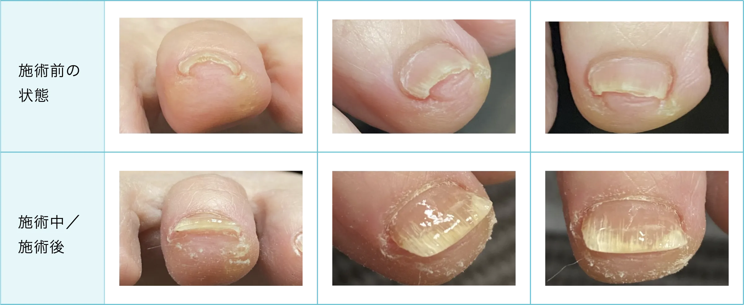 症例と施術経過