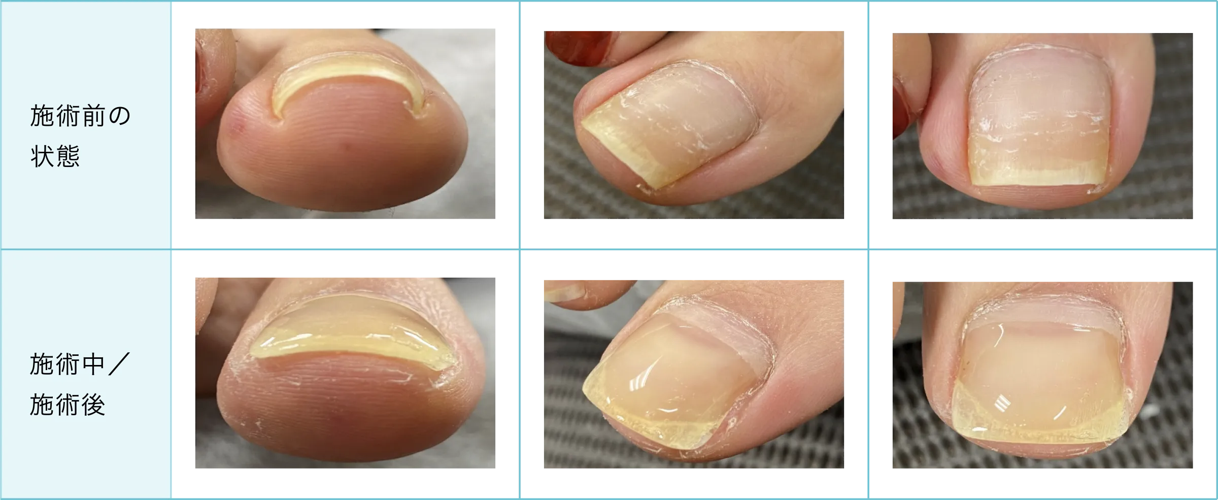 症例と施術経過