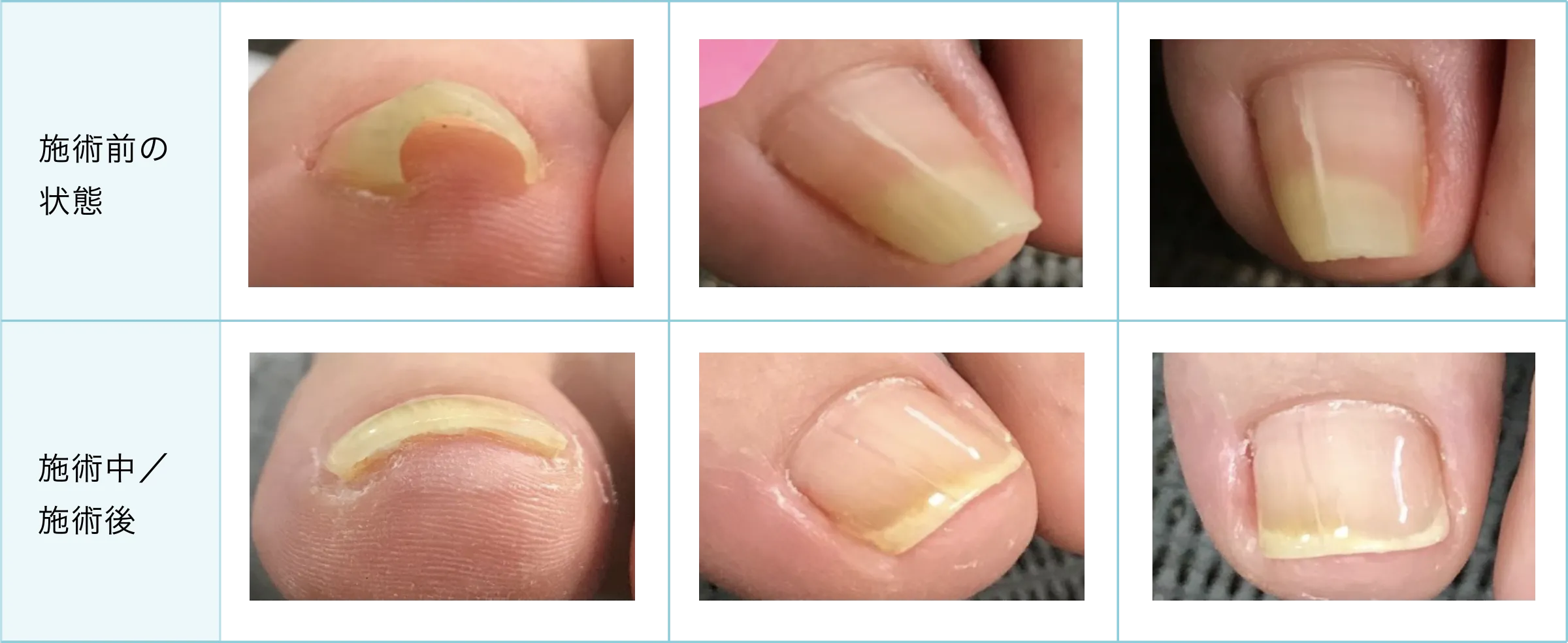 症例と施術経過