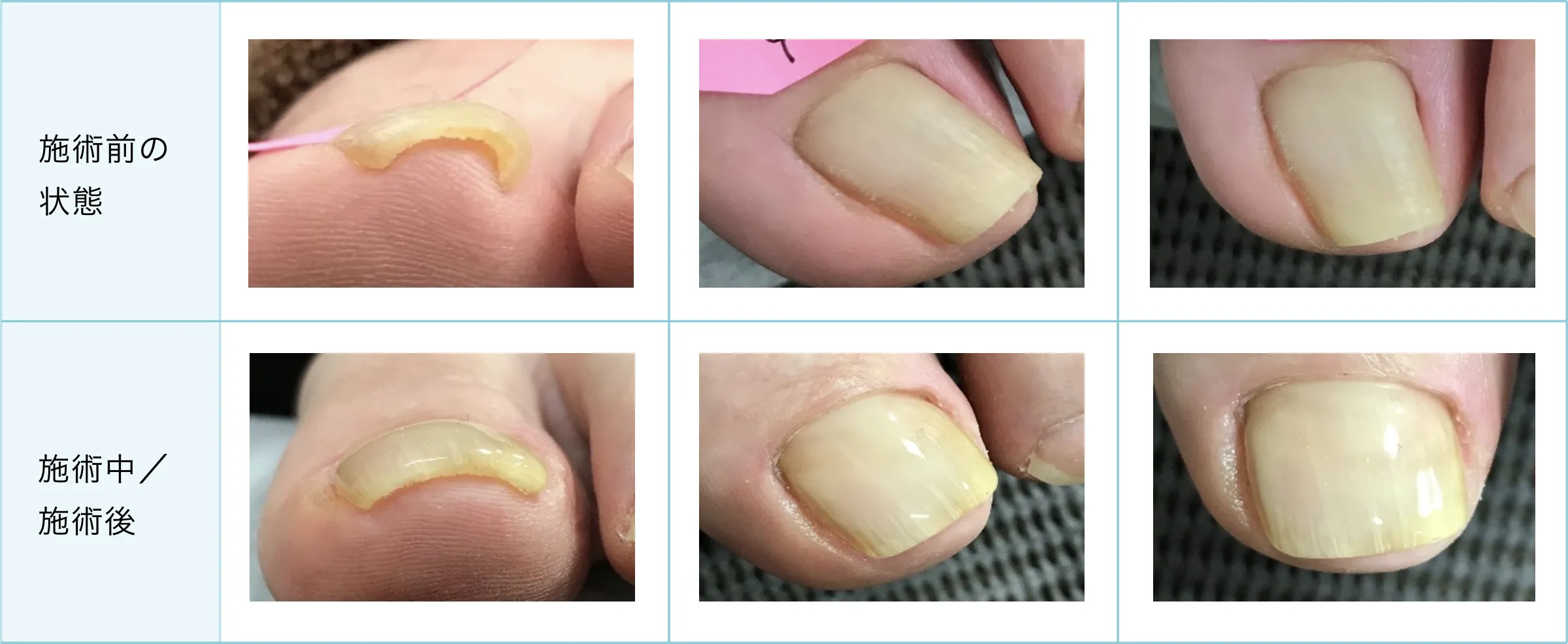 症例と施術経過