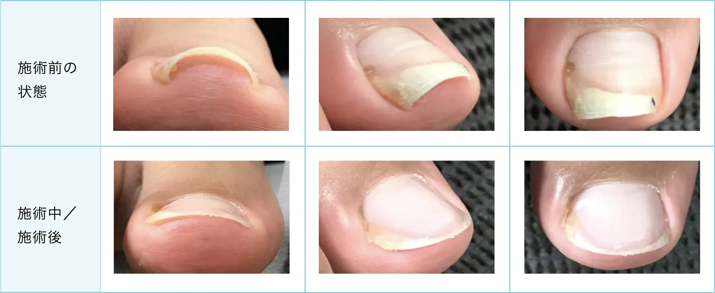 症例と施術経過