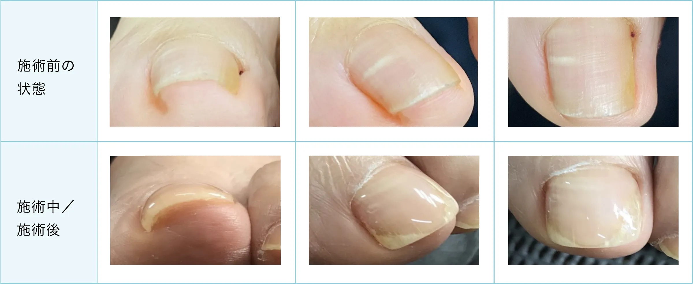 症例と施術経過